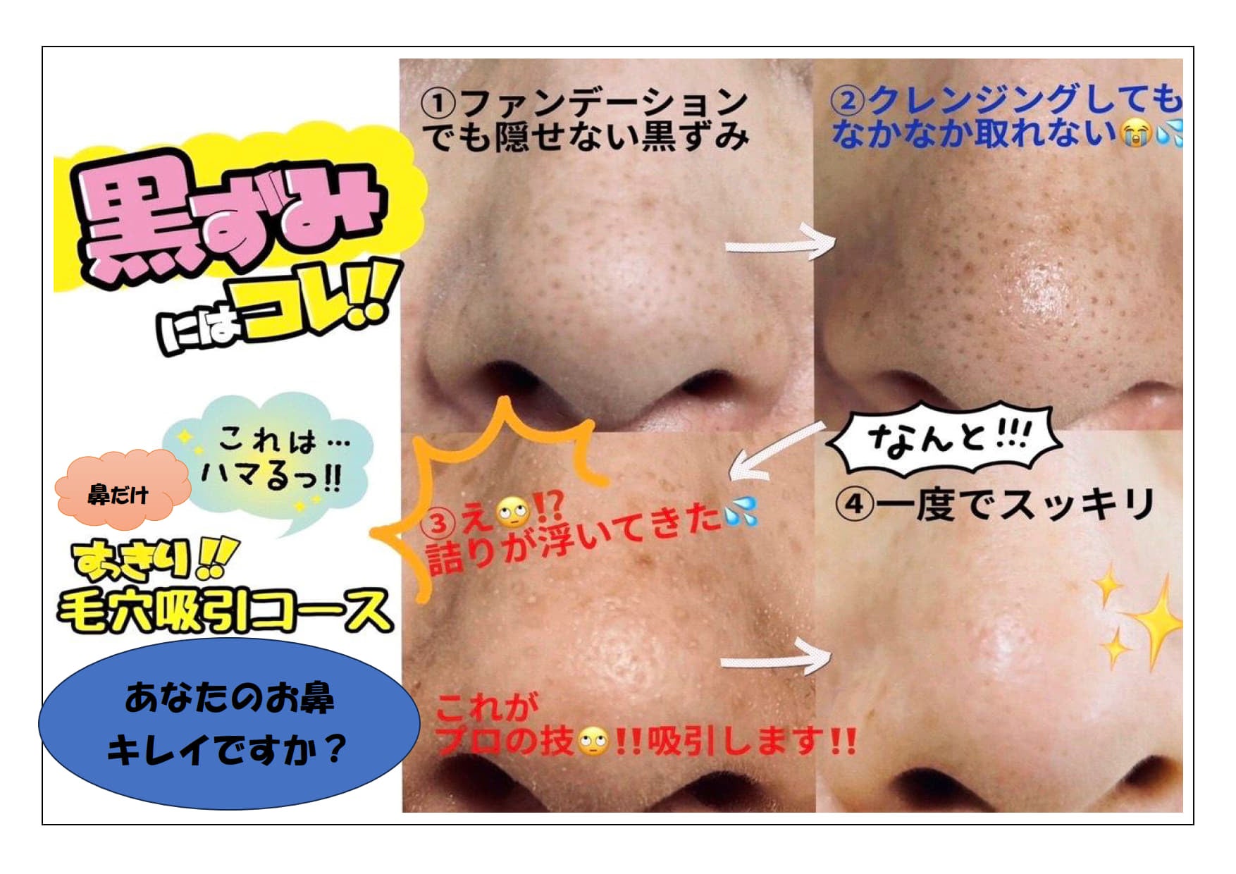 エルミィハート豆花(まめはな)の小鼻キレイキレイ（パックなし）の写真