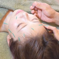 ことり美容鍼灸サロンのことりの美容鍼ショートコース(約50分)初回限定の写真
