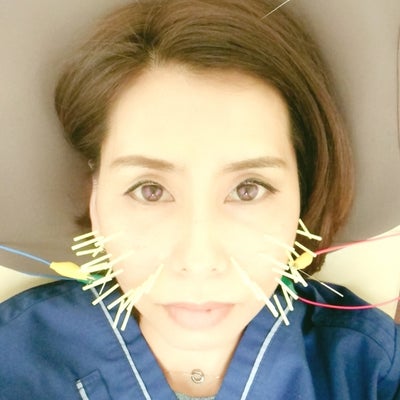 2018/01/31に府中新町鍼灸整骨院が投稿した、メニューの写真