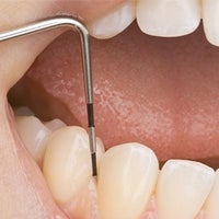 医療法人社団健弘会　せんげん台くすのき通り歯科の歯周病治療の写真