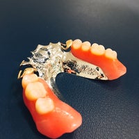 千石ひかり歯科の金属義歯の写真