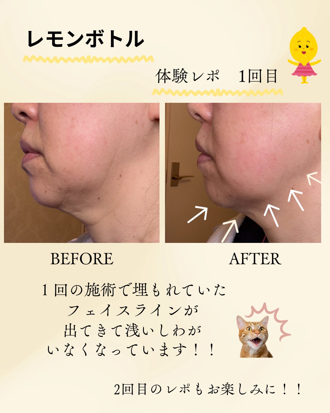 頭のオアシすぱのドライヘッドスパ+レモンボトルの写真