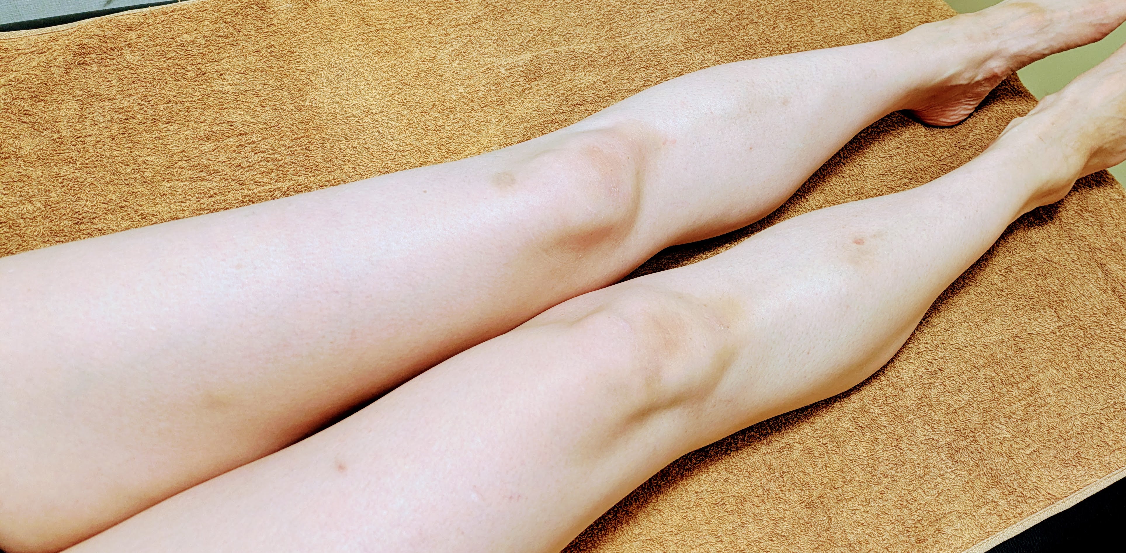 れらのリンパドレナージュ　下半身（お腹も含む）　60分 の写真