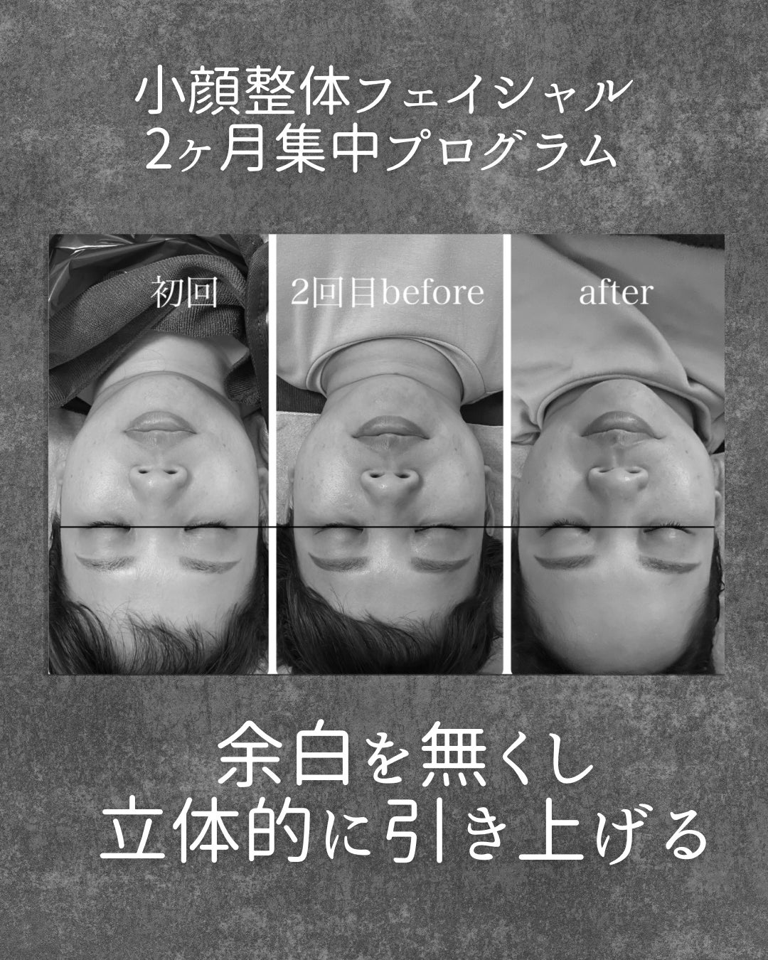 小顔整体フェイシャル2ヶ月コースの写真