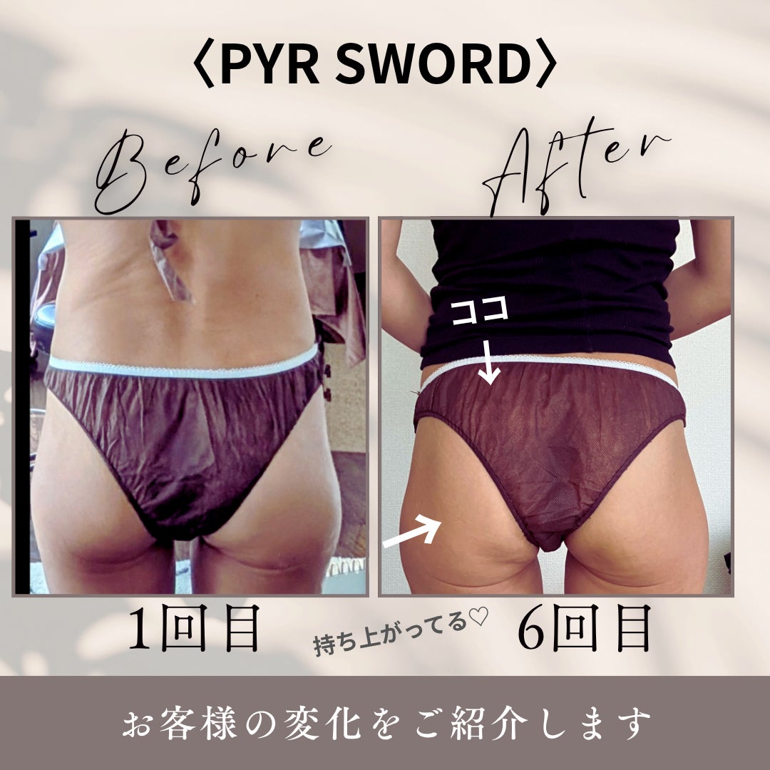 パイラSWORDの写真