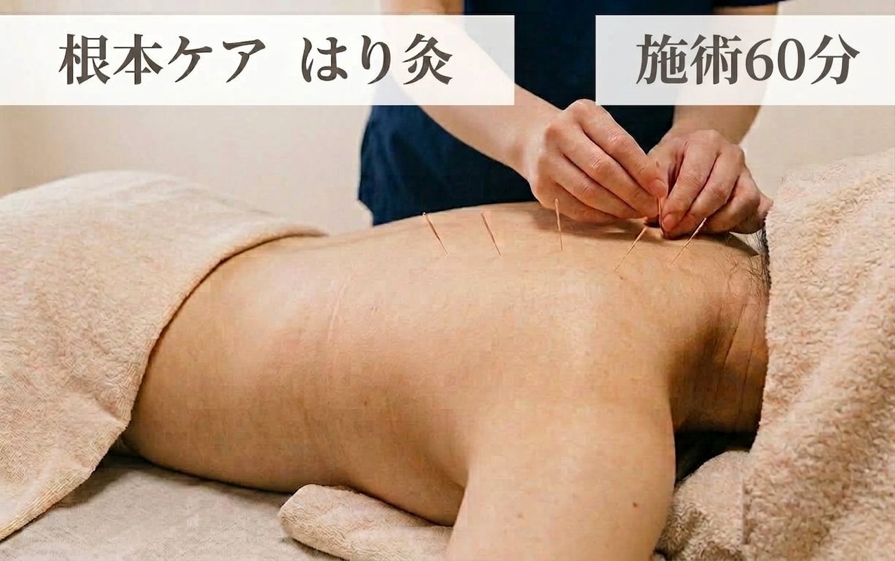 エデ鍼灸の【お悩みの集中ケアに】頭皮鍼＋全身鍼灸コース（60分）の写真