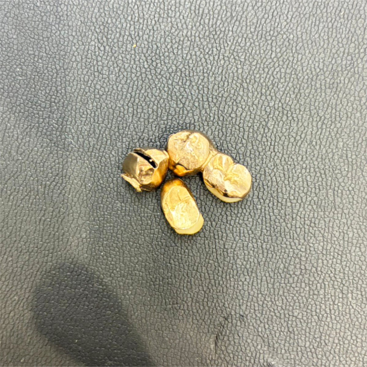 歯医者さんから返却された金歯 をお持ち込みいただきました！！の写真