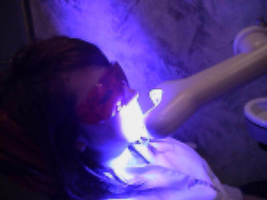 ティースアートデンタルクリニックのブライトホワイトの写真