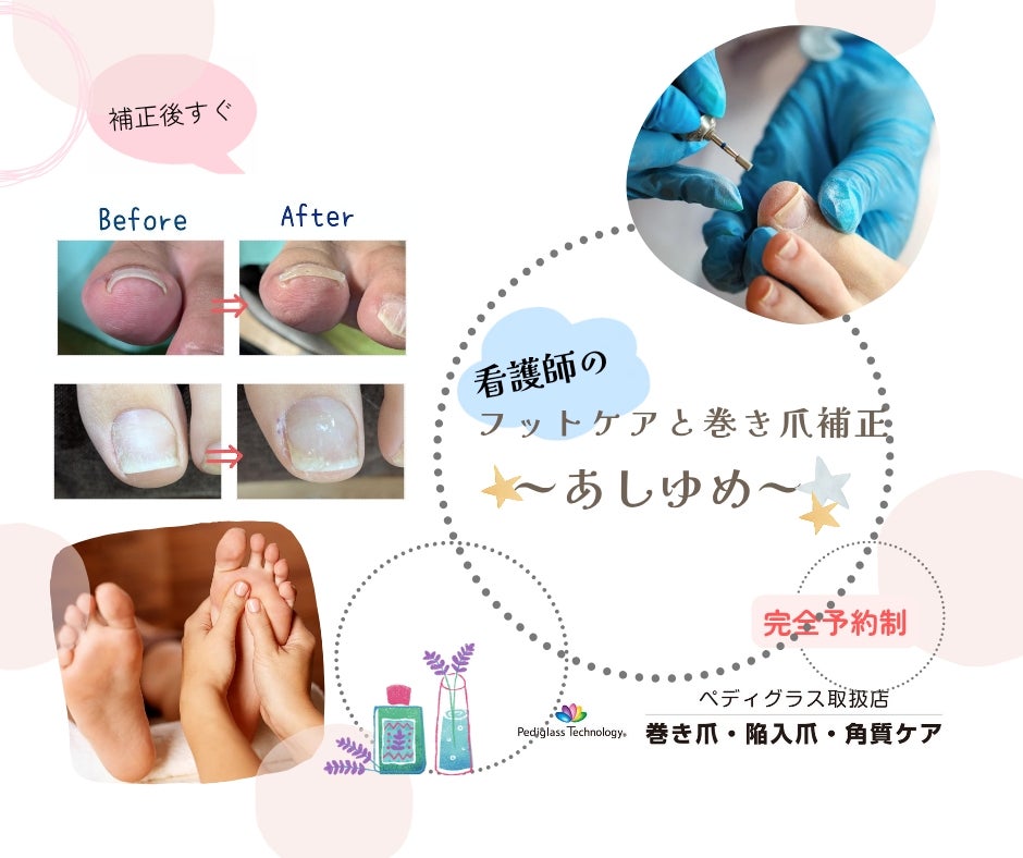 フットケアと巻き爪補正　〜あしゆめ〜の紹介写真_1枚目