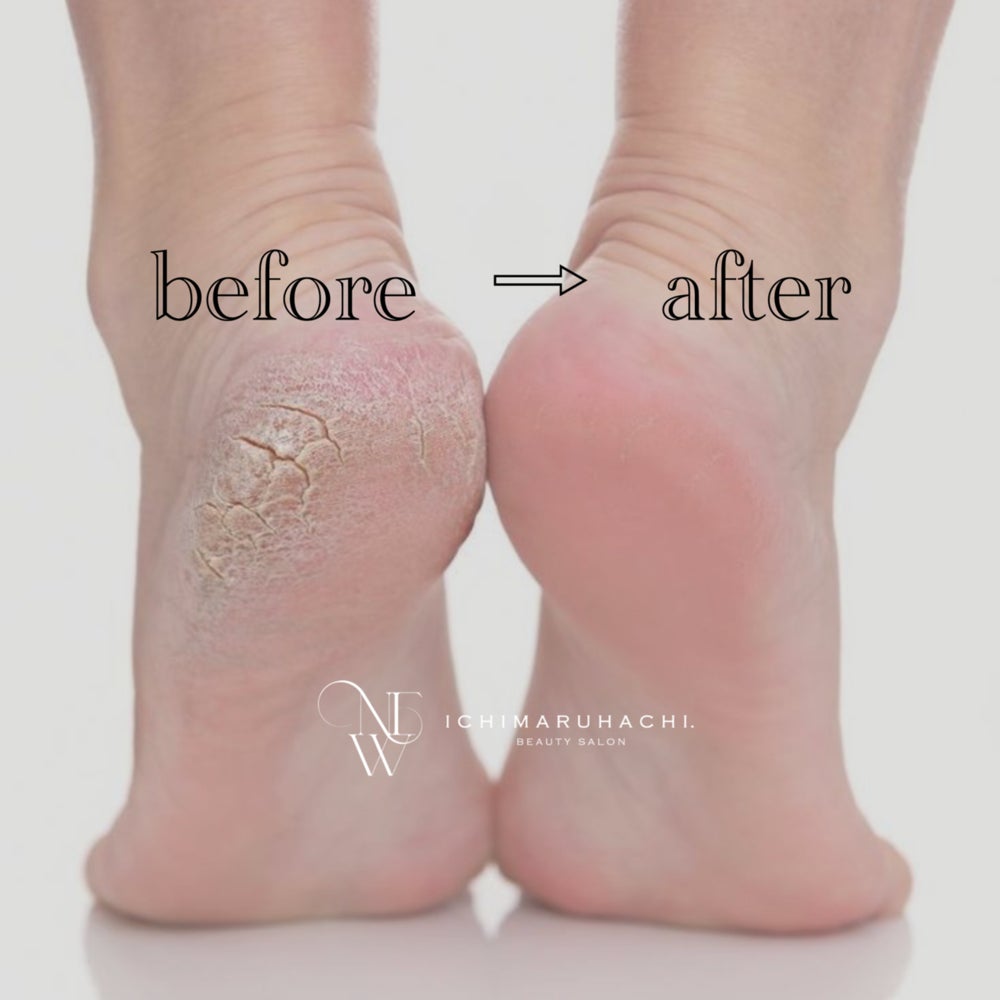 Nail.108の足裏角質除去の写真