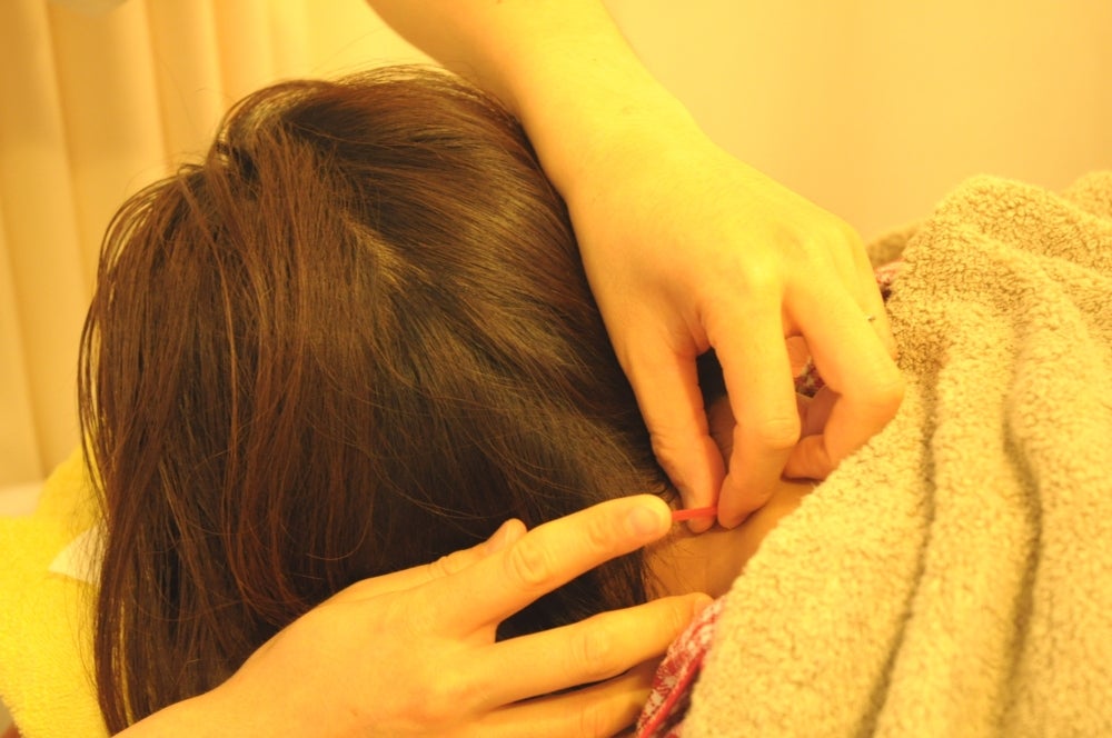 パルモ鍼灸マッサージ院のメニューの写真 - 鍼治療