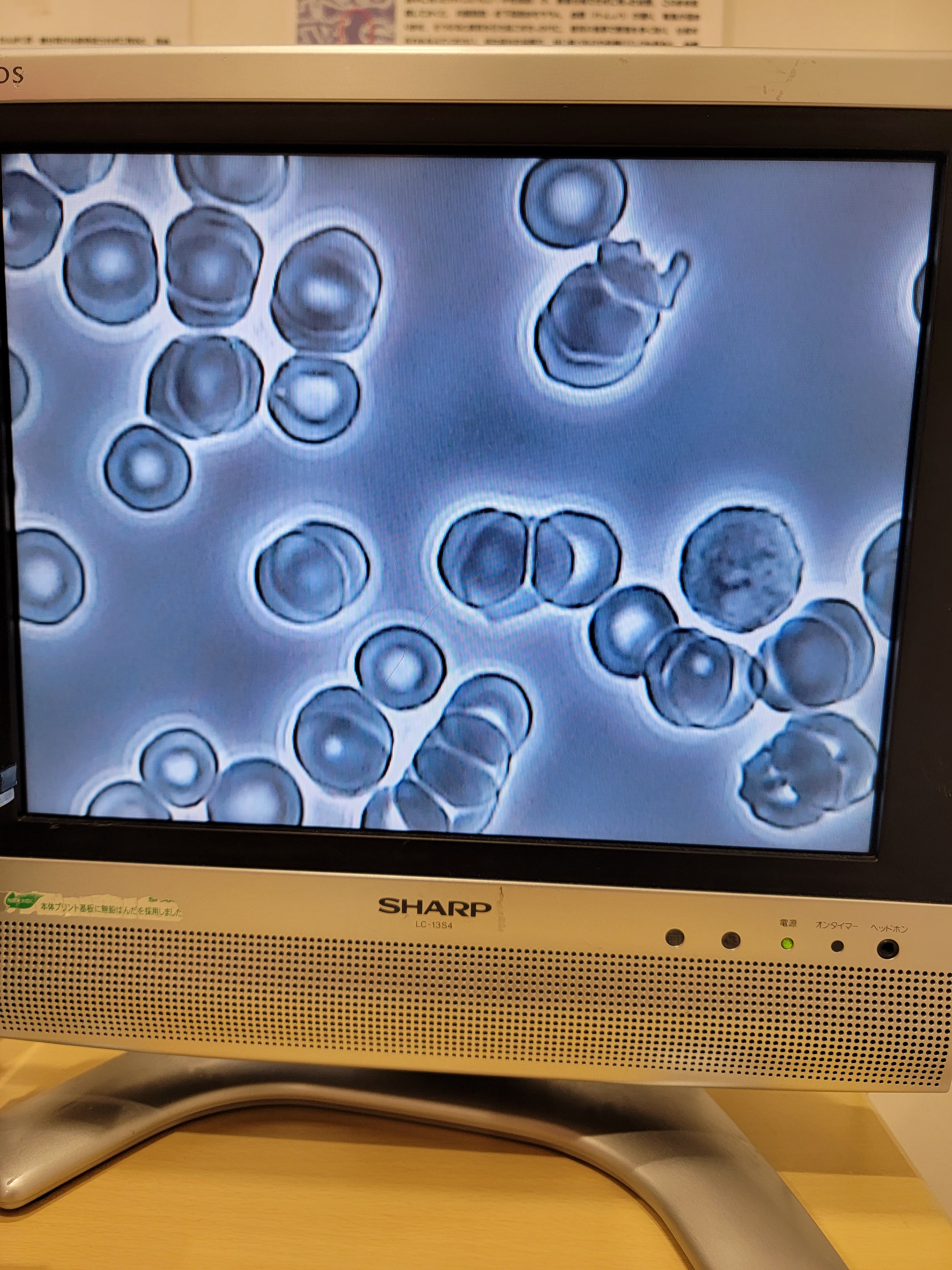 篠崎北口はりきゅう整骨院のその他の写真 - 酵素のむ前施術前の赤血球